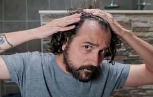 تغذیه در برابر سر طاس؟: محقق تغذیه فاش می کند که واقعاً در مورد ریزش موهای ارثی کمک می کند